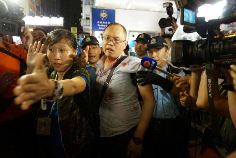 A pro-democracy protester attacked by thugs in Mongkok. He accused the police for keeping a blind eye to the attack act. Photo from inmediahk.net