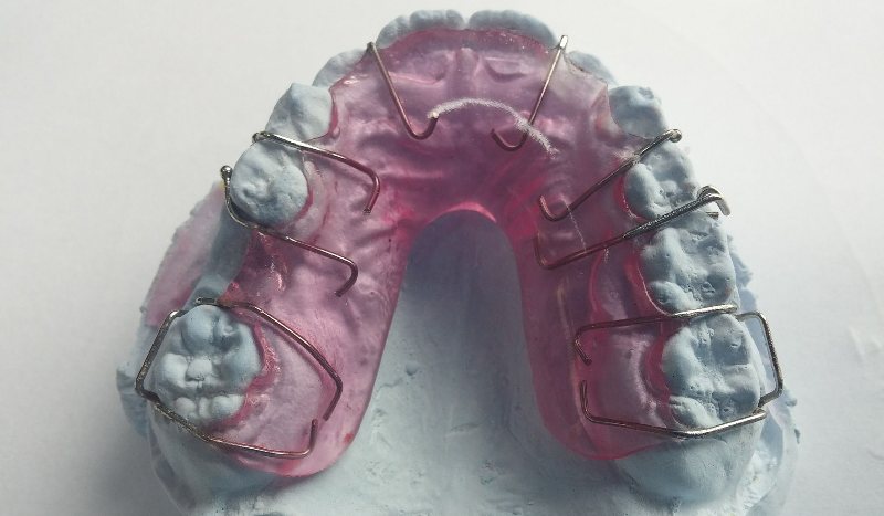 appareil dentaire